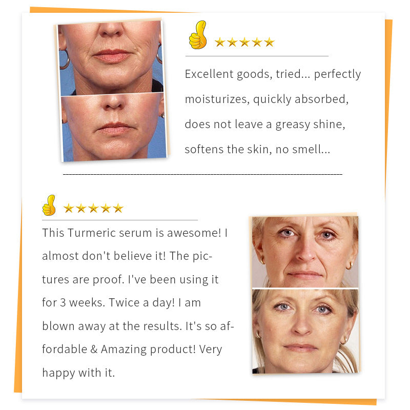 SAUVASINE 30ml Turmeric Serum for Face Care